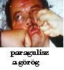 paragulisz
