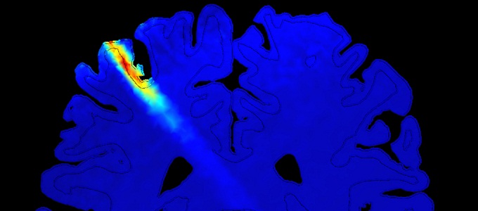 Fokozza az érzékelést az ultrahang
