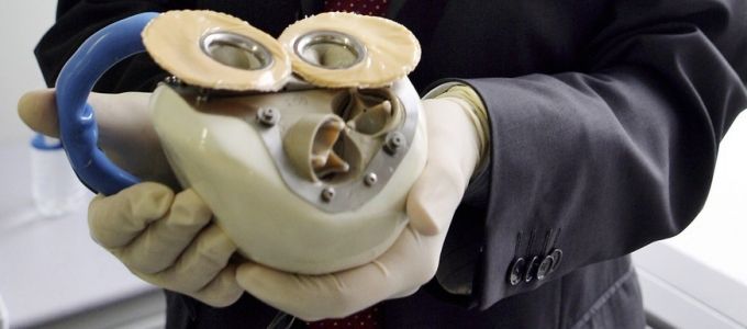 Meghalt az elsõ teljesen mûszíves beteg