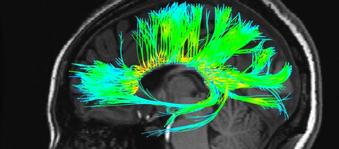 Gondolatolvasás agyletapogatással