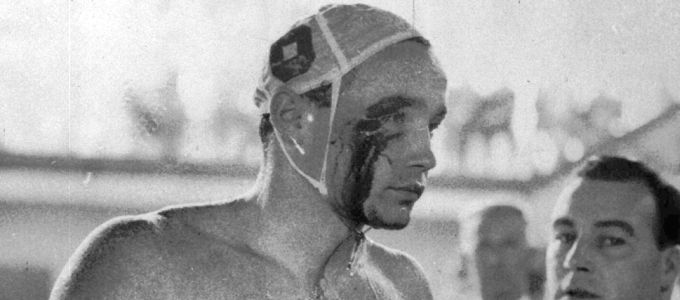 Vérfürdõ a medencében