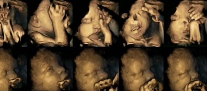 A magzat arca tükrözi az anya dohányzásának káros hatásait