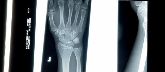 Diagnózis orvos nélkül