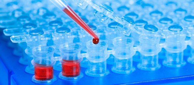 Génteszteket és hajelemzést a doppingolók ellen