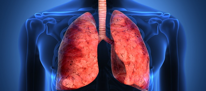 Szén nanocsövekkel szennyezzük tüdõnket