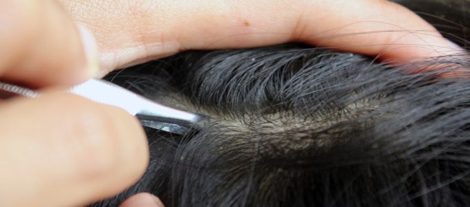 A szelfik miatt egyre több a fejtetves holland középiskolás