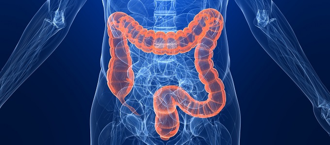 Fiatalok körében terjed a végbélrák