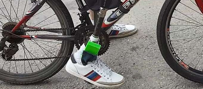 Hosszú út vezet még a gondolattal vezérelt protézisekig