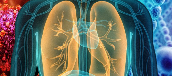 Új szenzorok derítik ki a tüdõgyulladás okát