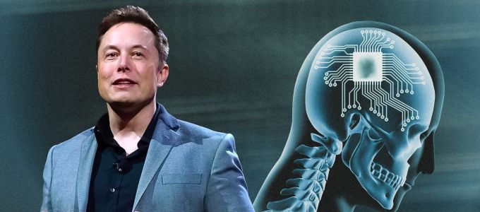 Chipet ültetett egy ember agyába Elon Musk cége